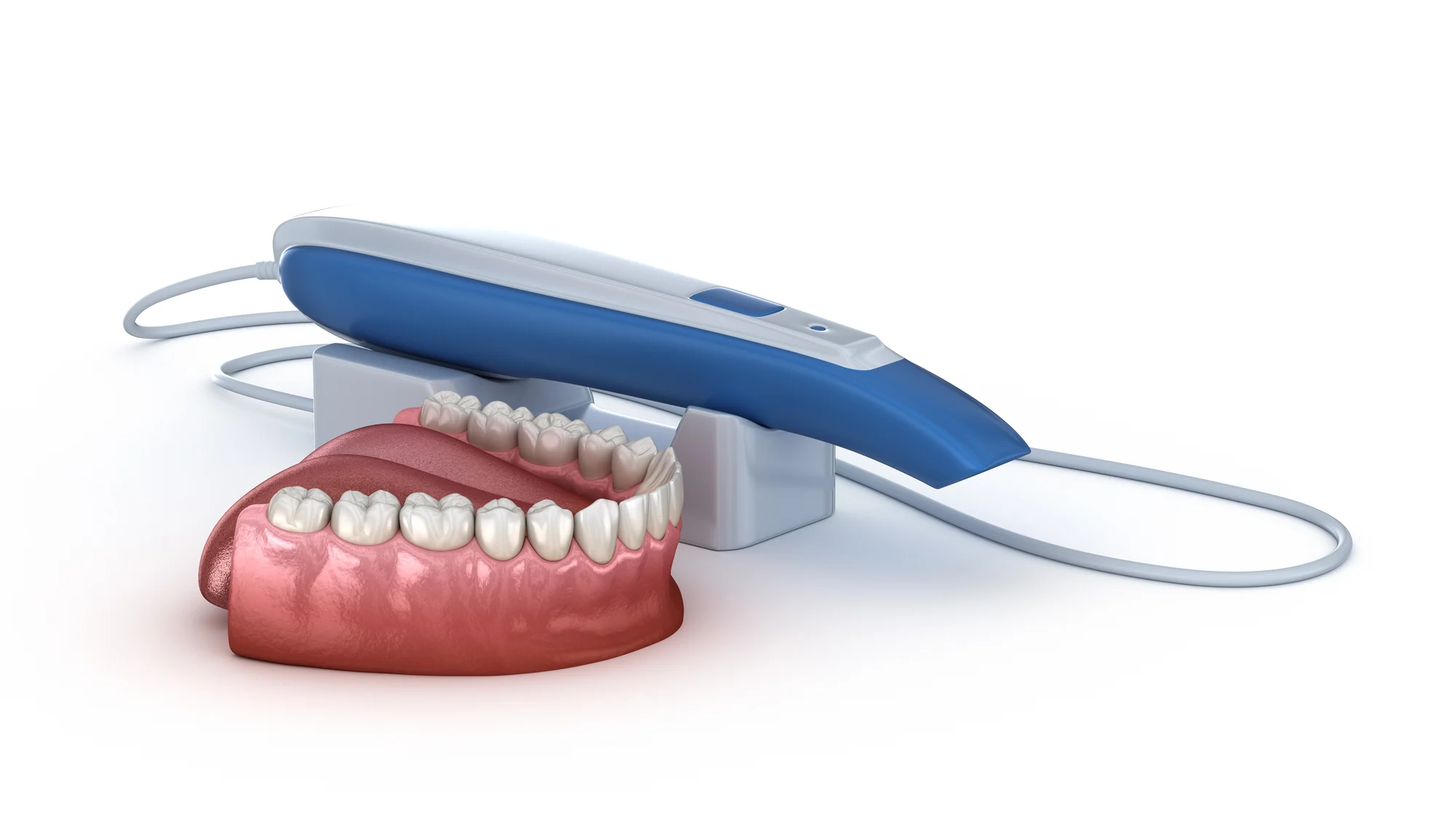 Depositphotos_313506214_L Intraoralscanner